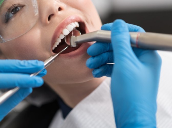 洗牙的好處和壞處