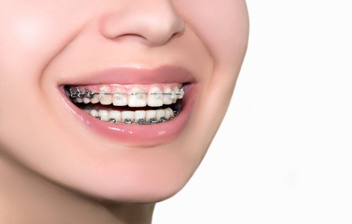 牙齿咬合不正影响