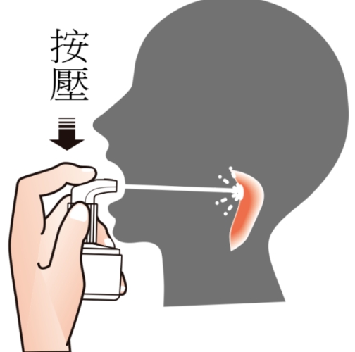 口腔消炎噴劑推薦