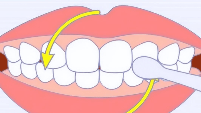 貝氏刷牙法​定義