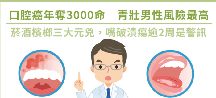 口腔癌治療 口腔癌治療