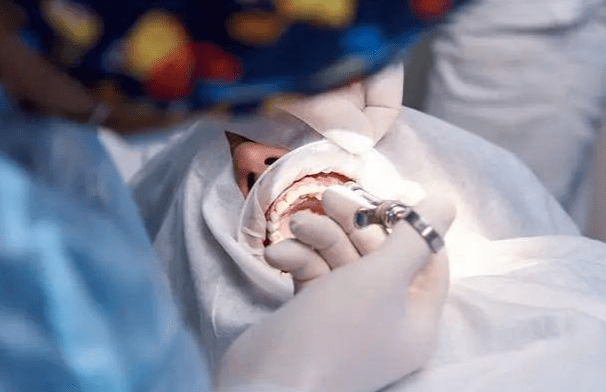 口腔癌篩查 口腔癌篩查