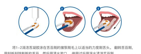 舌苔清潔​注意事項