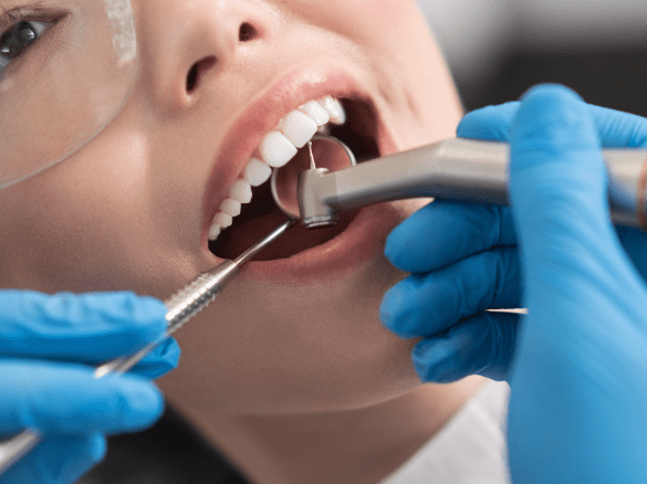 口腔內壁長水泡診斷 口腔內壁長水泡診斷