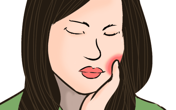 口腔內壁腫起來的​處理方式