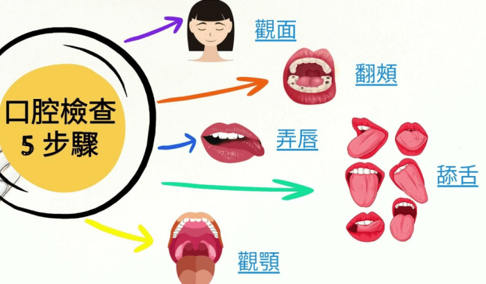 口腔黏膜檢查​費用