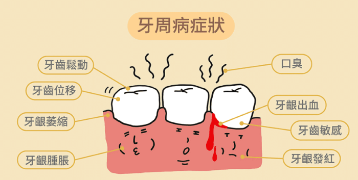 牙齦流血不止該怎麼辦