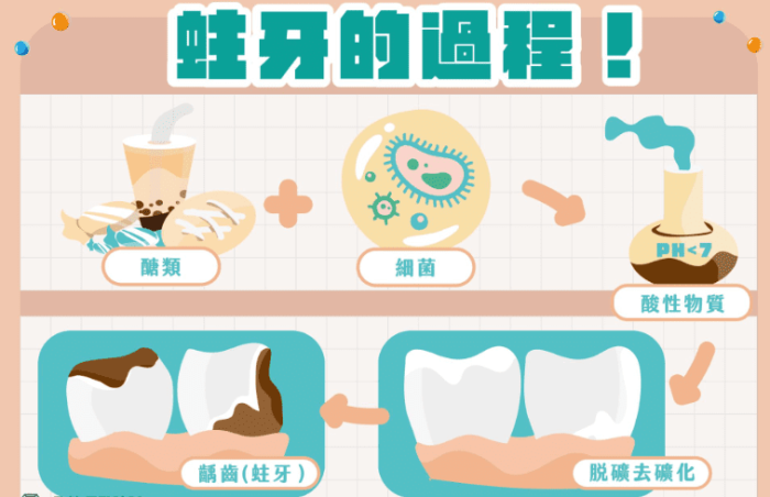 蛀牙形成原因