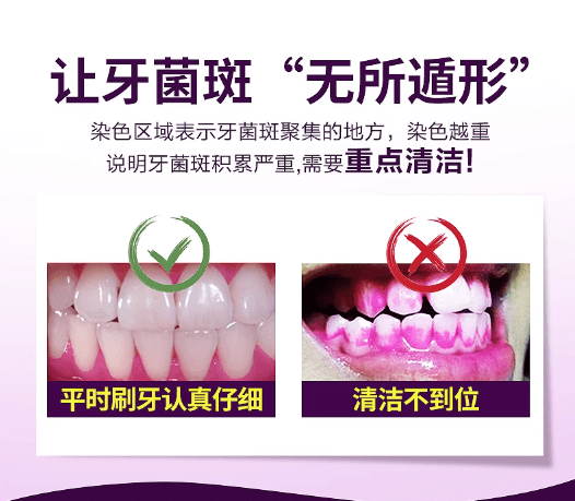 牙齒染色怎麼去除