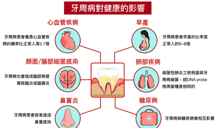 牙周病症狀分級