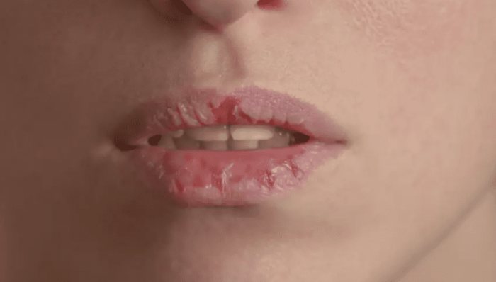 口乾的風險因素