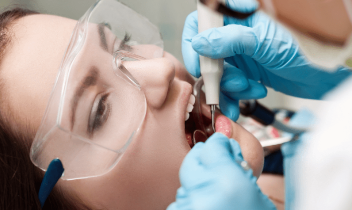 去除牙漬的3大秘訣