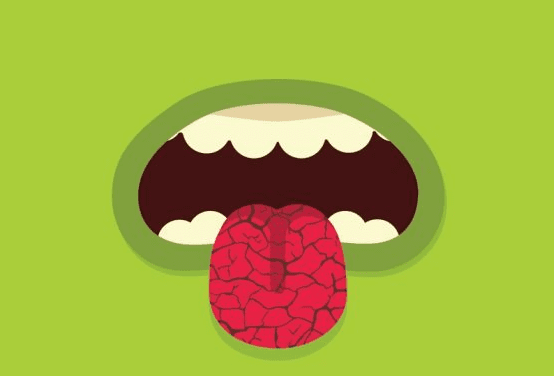 口乾的診斷與治療