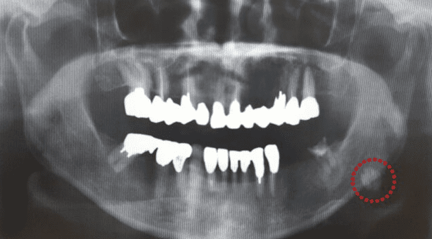 唾液腺位置在哪裡有哪些功能