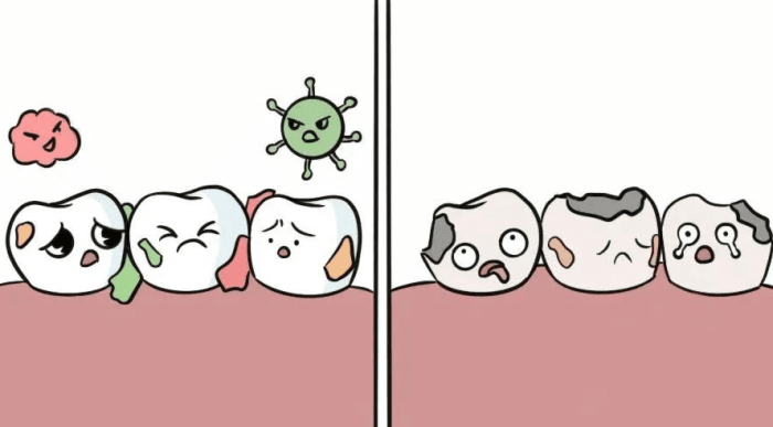 牙漬形成的7種原因