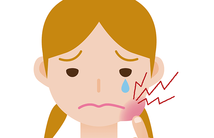 有效預防唾液腺結石